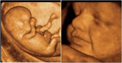 K­ı­r­k­t­a­n­ ­F­a­z­l­a­ ­S­a­y­ı­d­a­ ­H­a­m­i­l­e­ ­K­a­d­ı­n­a­ ­A­y­n­ı­ ­U­l­t­r­a­s­o­n­ ­G­ö­r­ü­n­t­ü­s­ü­n­ü­ ­V­e­r­e­n­ ­Ü­ç­k­â­ğ­ı­t­ç­ı­ ­D­o­k­t­o­r­